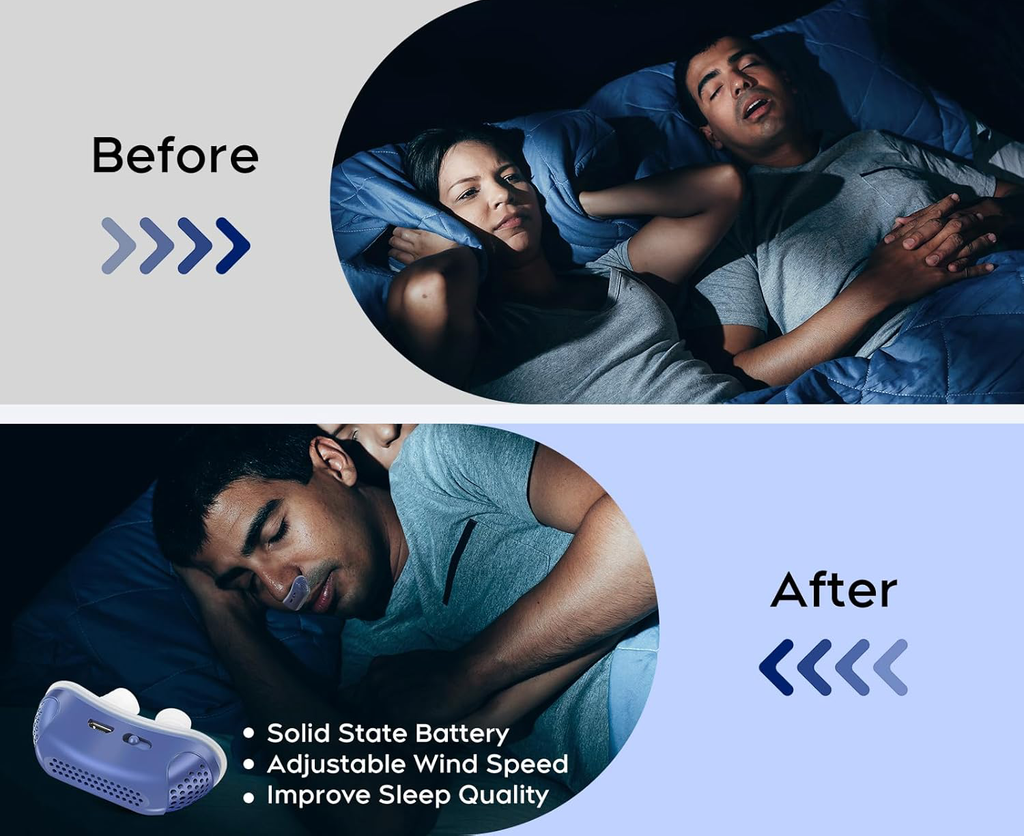 Micro CPAP Sleep Apnea Machine – Portable Travel Use, Anti Snoring Solution