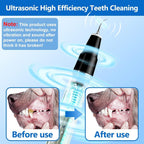 Pet Tartar Remover Ultrasonic Tooth Cleaner – Dental Care, Oral Hygiene